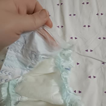 Baby Me 6 Numaralı Bebek Bezlerinde Cırtı Kırılma Sorunu Ve Ücret İadesi Talebi
