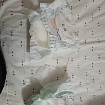 Baby Me 6 Numaralı Bebek Bezlerinde Cırtı Kırılma Sorunu Ve Ücret İadesi Talebi