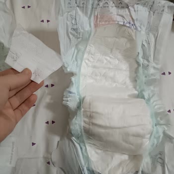 Baby Me 6 Numaralı Bebek Bezlerinde Cırtı Kırılma Sorunu Ve Ücret İadesi Talebi