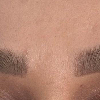 Microblading Sonrası Yanıltıcı Yönlendirme Ve Sorumluluk Reddi