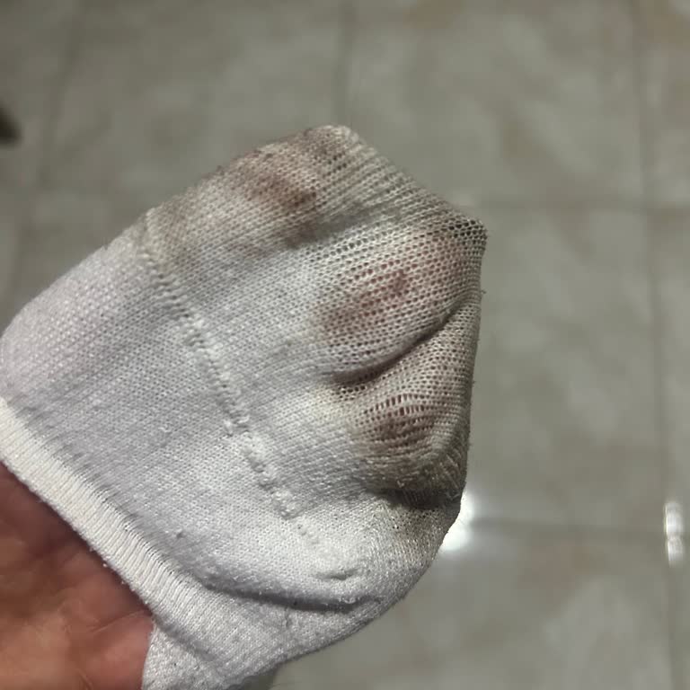 Derimod Ayakkabılarının Çorapları Boyaması Ve Fatura Sorunu