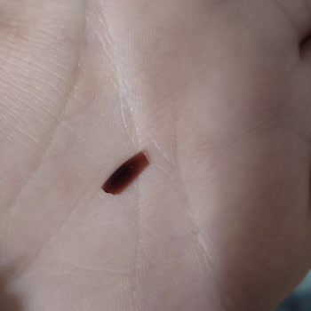 Knorr Kremalı Mantarlı Çorbanın İçinde Plastik Parça Bulundu