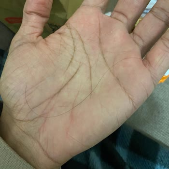 Kıl Çıkan Burger King Siparişinde Hijyen Sorunu Ve İlgisiz Yemeksepeti Desteği