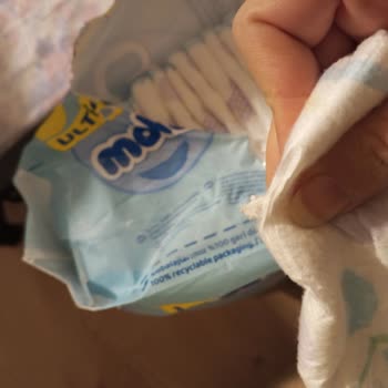 Molfix Bebek Bezinde Kesici Kristal Parçalar: Güvenlik Endişesi