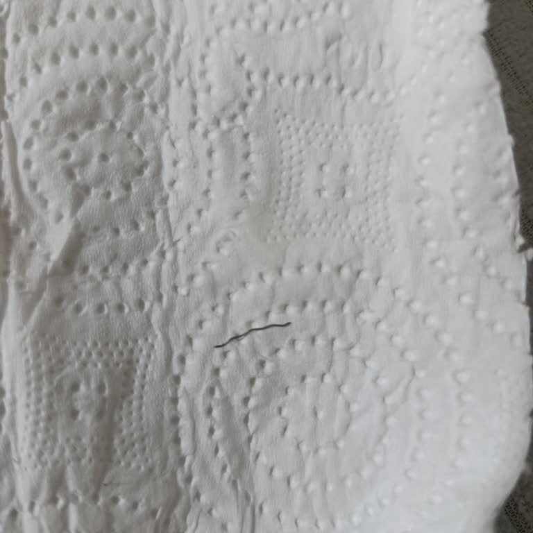 Mopaş Markette Satılan Tavukta Metal Tel Cismi Çocuk Güvenliğini Tehlikeye Atıyor