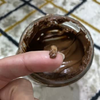 Nutella’da Dişe Benzer Yabancı Cisim Ve Yetersiz Müşteri Yanıtı