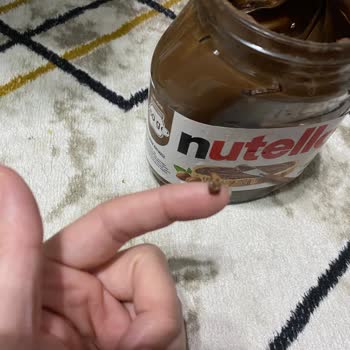 Nutella’da Dişe Benzer Yabancı Cisim Ve Yetersiz Müşteri Yanıtı