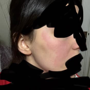 Uni Baby Islak Mendilde Bebek Ve Anne Cildine Yanık Ve Tahriş