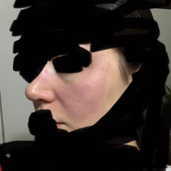 Uni Baby Islak Mendilde Bebek Ve Anne Cildine Yanık Ve Tahriş