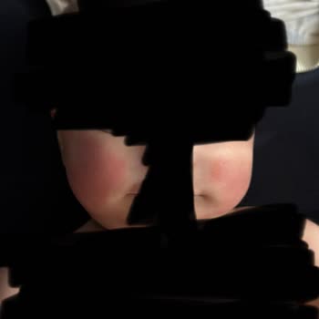 Uni Baby Islak Mendilde Bebek Ve Anne Cildine Yanık Ve Tahriş