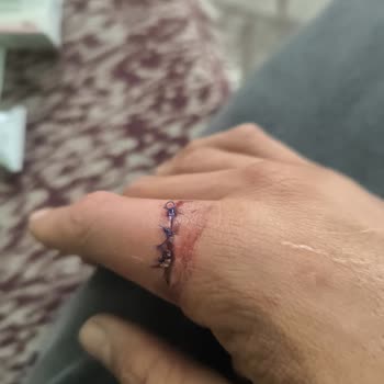 Trip.com Belgeleri Havayoluna İletmediği Ve İade Yapmadığı İçin Tam Geri Ödeme Talebi