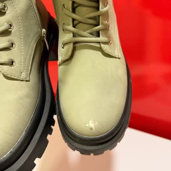 Kalitesiz Botta Deri Soyulması Ve Mağazanın Sorumluluk Reddi