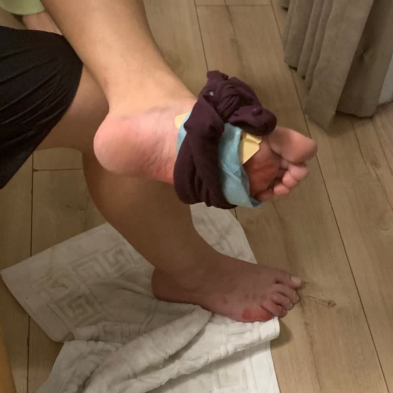 Bons Villa Havuz Güvenliği İhmalinden Ayağım Yaralandı Ve Ücret İadesi