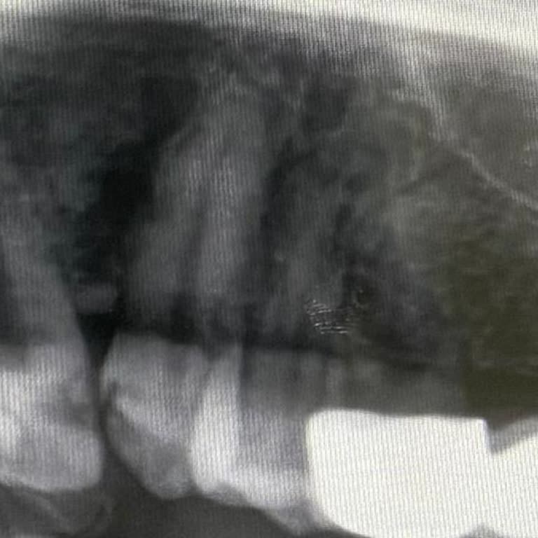 Diva Ağız Ve Diş Sağlığı Polikliniği Yaşadığım Sağlık Riski