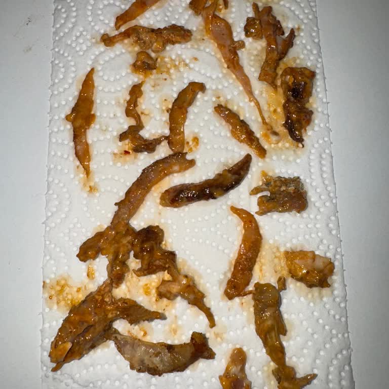 Çiğ Deri Ve Kemik İçeren Dönerde Gıda Güvenliği İhlali Ve İade Reddi