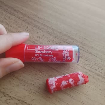 Küflü Dudak Nemlendiricisinde Şiddetli Yanma Ve Ciddi Çatlak