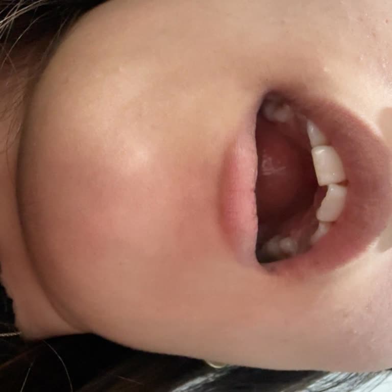 Dentapol Kırıkkale'de Bilgilendirme Eksikliği Ve Tekrar Ücret Talebi