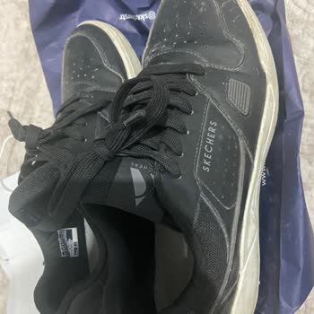 Skechers Mağazasında Garanti Kapsamındaki Ayakkabının Deformasyonu Ve Değişim Talebi