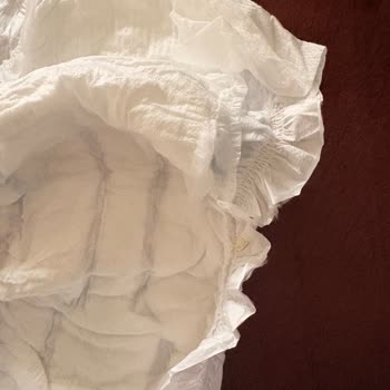 Molfix Bebek Bezinde Yırtık Ve Jel Sızıntısı, Trendyol Siparişinde Mağduriyet