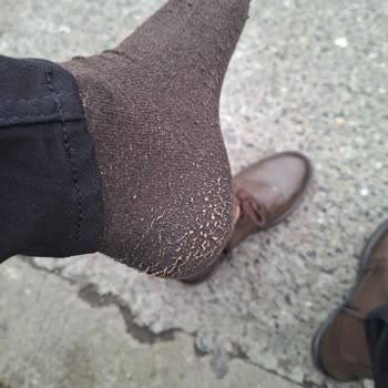 Deriden Gelen Renk Değişimi Ve Çorap Hasarı Nedeniyle Mağdur Oldum İade Talep Ediyorum