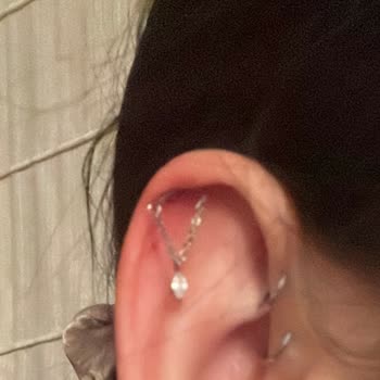 Bellum Tattoo’da Hatalı Piercing Sonrası Şiddetli Enfeksiyon Ve Kulağımda Kayıp Riski