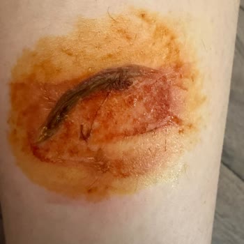 Ankara Ekspresi 4. Vagon Tuvaletinde Bacak Yanığı Güvenlik İhmaline İşaret