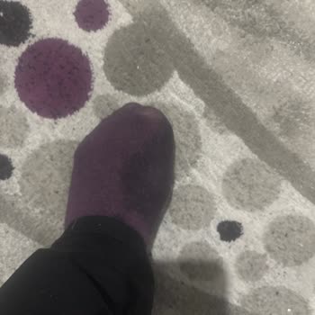 Skechers Kısa Sürede Dikiş Açılması ve Su Geçirme Sorunu Üretim Hatası İtirazı