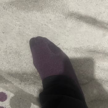 Skechers Kısa Sürede Dikiş Açılması ve Su Geçirme Sorunu Üretim Hatası İtirazı