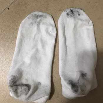 Aldo Botunun Boyası Çorap Ve Tırnaklara Geçti, Kullanılamaz Durumda