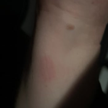 Buhar Makinesinin Patlaması Ev Ve Can Güvenliğini Tehlikeye Atıyor