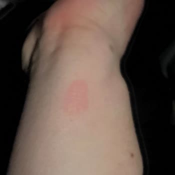 Buhar Makinesinin Patlaması Ev Ve Can Güvenliğini Tehlikeye Atıyor