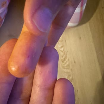 Niron Yatak Defolu Koltuk Takımı Ve Çocuk Yaralanması Sonrası Ücret Farkı Talebi