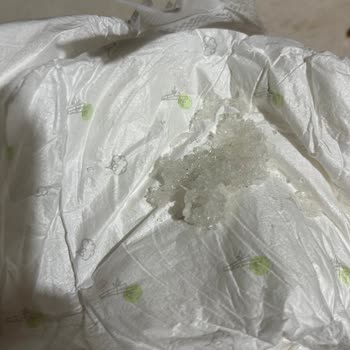 Sleepy Bebek Bezinde Yabancı Madde Çıktı Ve Çocuğum Kızarıklık Yaşadı