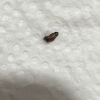 BİM Şubesinde İlkgün Çilek Reçelinde Böcek Bulunması Sağlık Endişesi