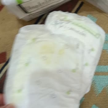 Yağlı Bebek Bezleri Ve Sağlık Riski Satıcı Horon Toptan