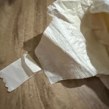 Sleepy Ecologic Bebek Bezinde Kapama Bantları Kopuyor