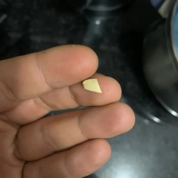 Baklavada Antep Fıstığı Kabuğu Dişimi Kırdı: Ücret İadesi Ve Tedavi Masrafı Talebi