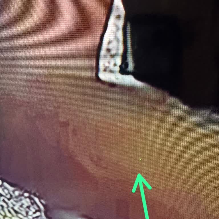 Skytech 65 İnç Televizyonda Ölü Piksel Ve Servis Reddi İadesi Talebi