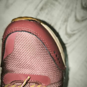 Skechers Ayakkabısında Kalite Sorunu Ön Burun Açılması Ve Deri Dökülmesi