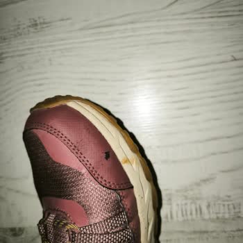 Skechers Ayakkabısında Kalite Sorunu Ön Burun Açılması Ve Deri Dökülmesi