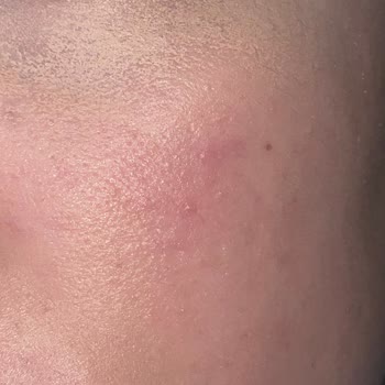 L'Loreal Göz Altı Kremi Kabuklanma Yaratıyor Ve Makyajı Bozuyor