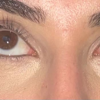 L'Loreal Göz Altı Kremi Kabuklanma Yaratıyor Ve Makyajı Bozuyor