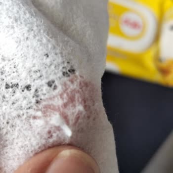 Watsons Dalin Islak Mendilinde Yabancı Madde Nedeniyle Cilt Çizikleri