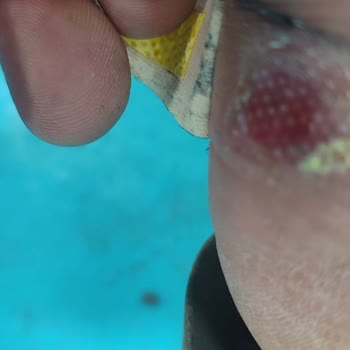 Sert Bot Arka Kısmı Ayağımı Yaraladı, İnceleme Yapmadan İade Reddi