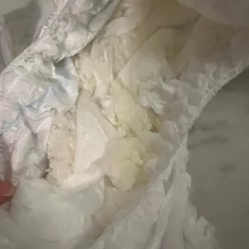 Molfix Çocuk Bezlerinde Çok Sayıda Defolu Ürün Ve Kalite Sorunu