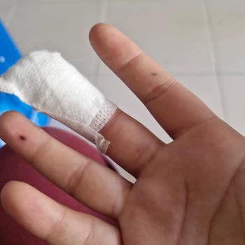 Kepez Devlet Hastanesi’nde Trafik Kazası Sonrası Yanlış Tanı Ve Raporlama İhmali