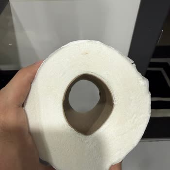 Kan Lekeli Tuvalet Kağıdı Hijyen Şikayeti Ve Ücret İadesi