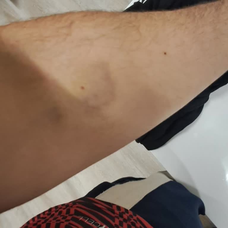 Yüksek Ücret, Uzun Bekleme Ve Amatör Kan Alım İşlemi Nedeniyle Mağduriyet