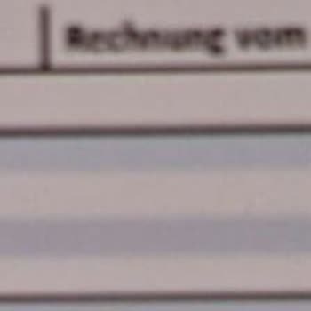 Maddi Ve Manevi Mağduriyet Yaratan Dermanew Serum Seti İade Talebi