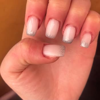 Sk Beauty Center’da Gizli Ücret Ve Ağrılı Uygulama Şikayeti